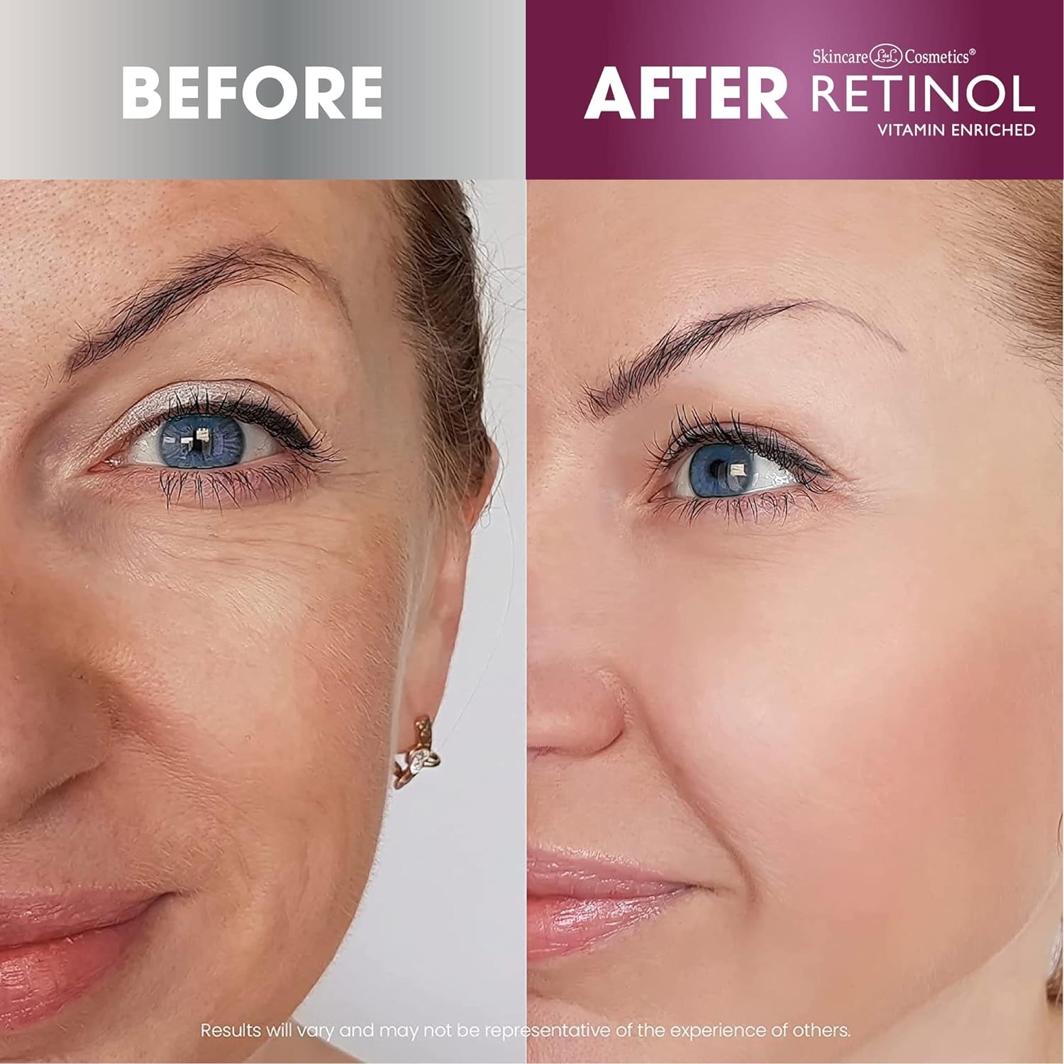 Retinol Advanced Skin Brightening Serum